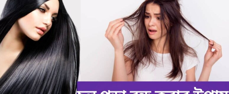 Hair Loss Treatments for Women: What Are the Best Options?